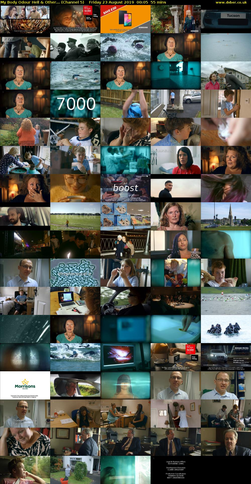 My Body Odour Hell & Other... (Channel 5) Friday 23 August 2019 00:05 - 01:00