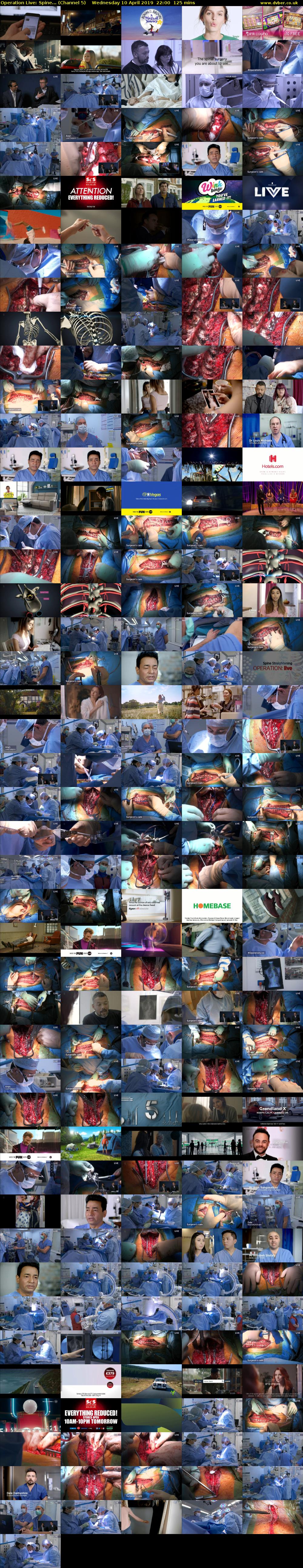 Operation Live: Spine... (Channel 5) Wednesday 10 April 2019 22:00 - 00:05