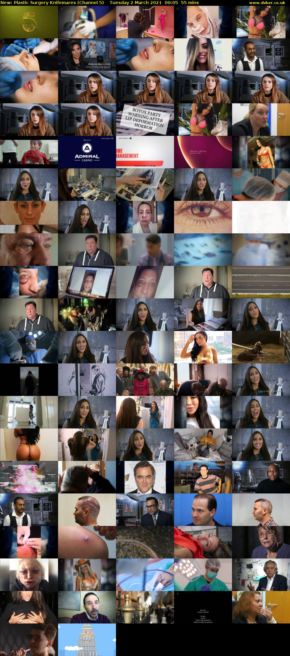 Plastic Surgery Knifemares (Channel 5) Tuesday 2 March 2021 00:05 - 01:00