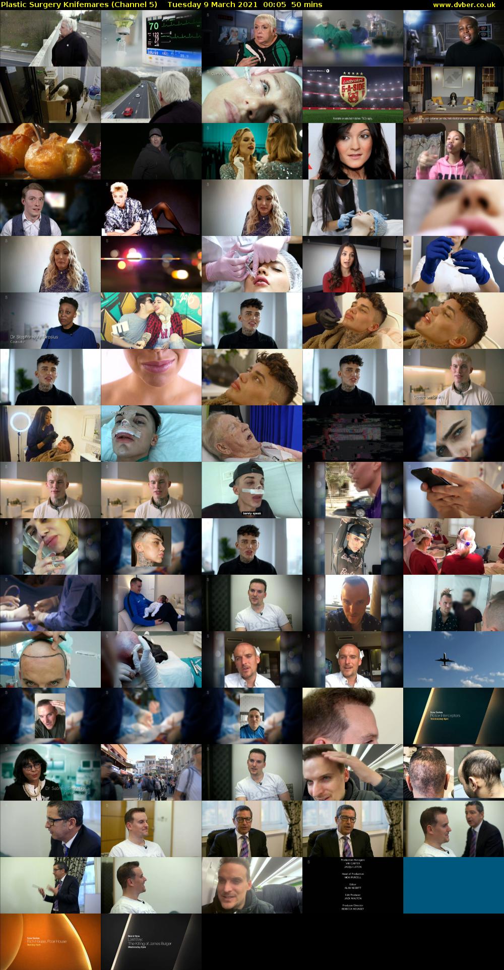 Plastic Surgery Knifemares (Channel 5) Tuesday 9 March 2021 00:05 - 00:55