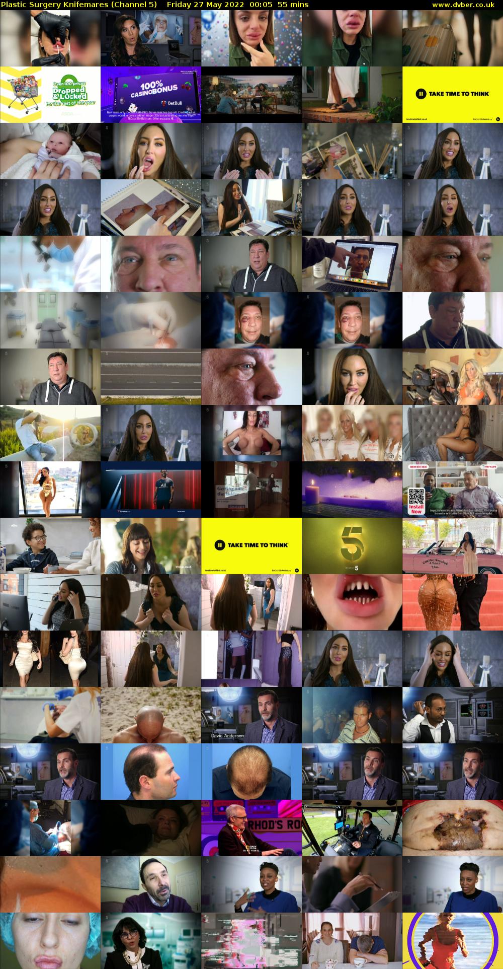 Plastic Surgery Knifemares (Channel 5) Friday 27 May 2022 00:05 - 01:00