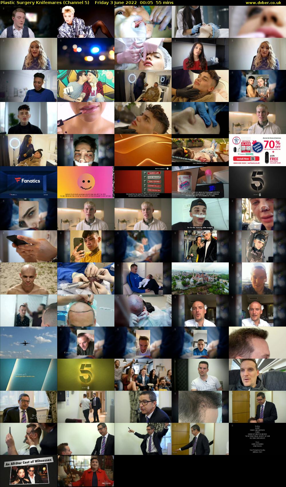 Plastic Surgery Knifemares (Channel 5) Friday 3 June 2022 00:05 - 01:00