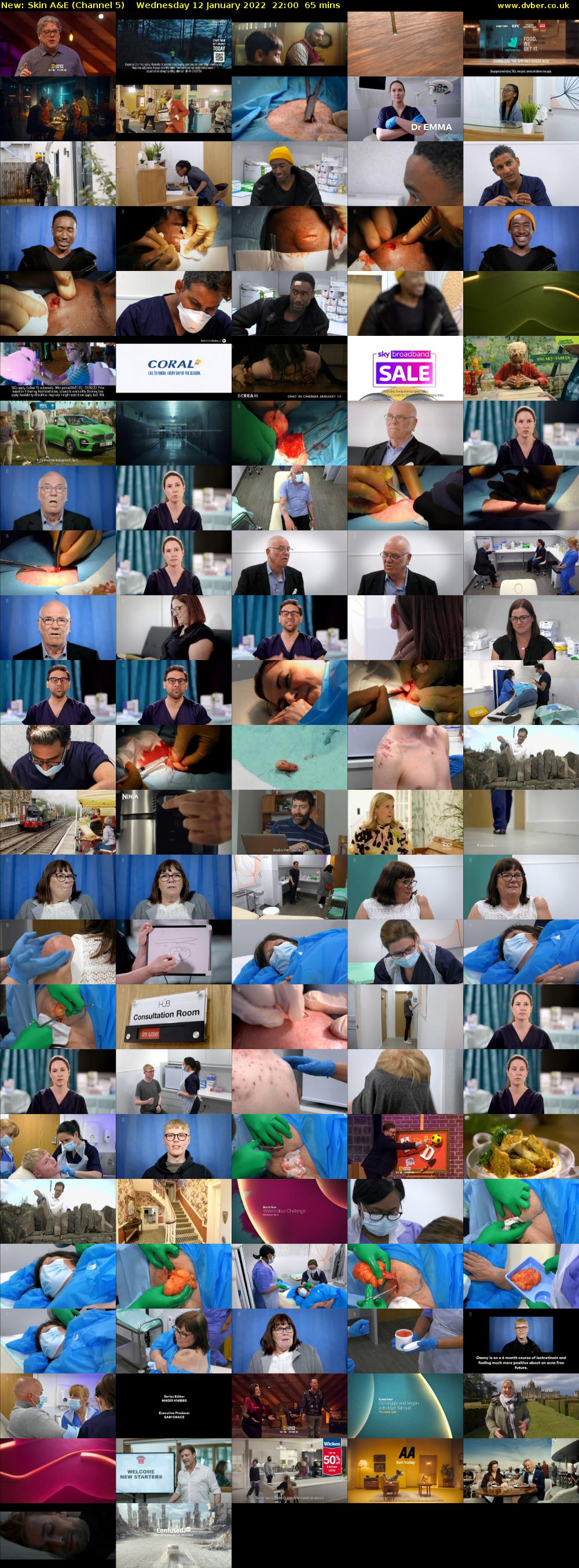 Skin A&E (Channel 5) Wednesday 12 January 2022 22:00 - 23:05