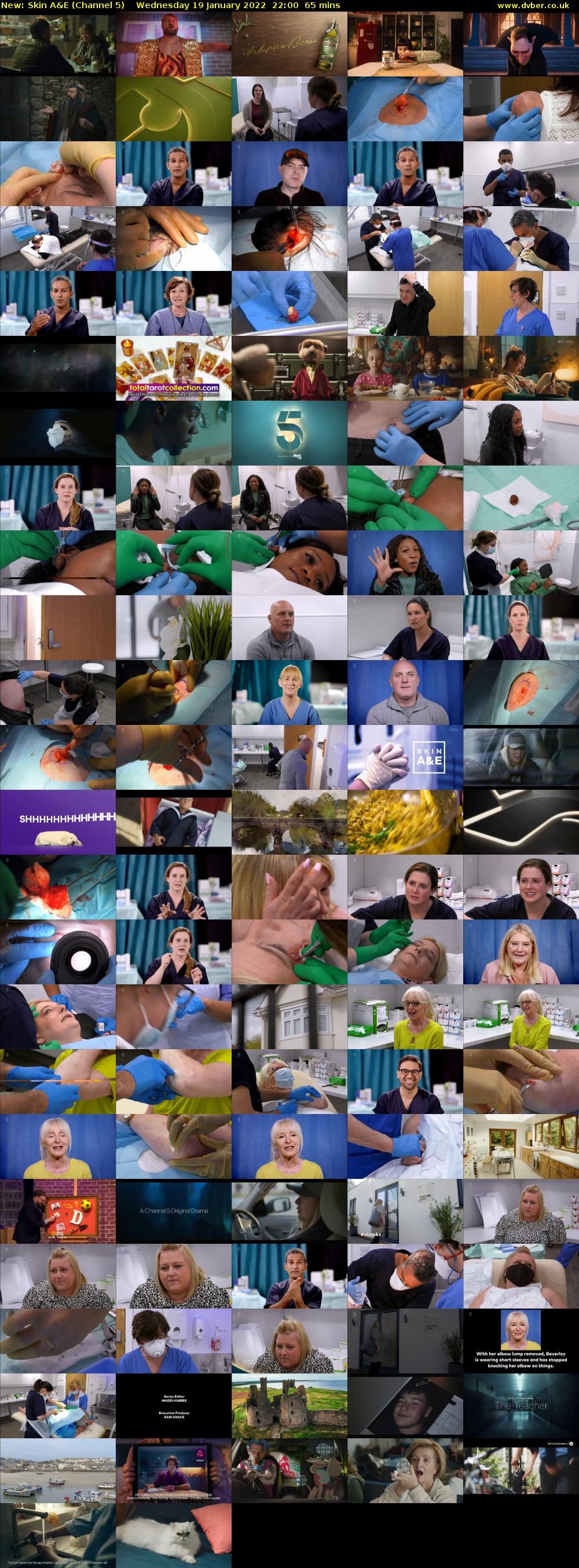 Skin A&E (Channel 5) Wednesday 19 January 2022 22:00 - 23:05