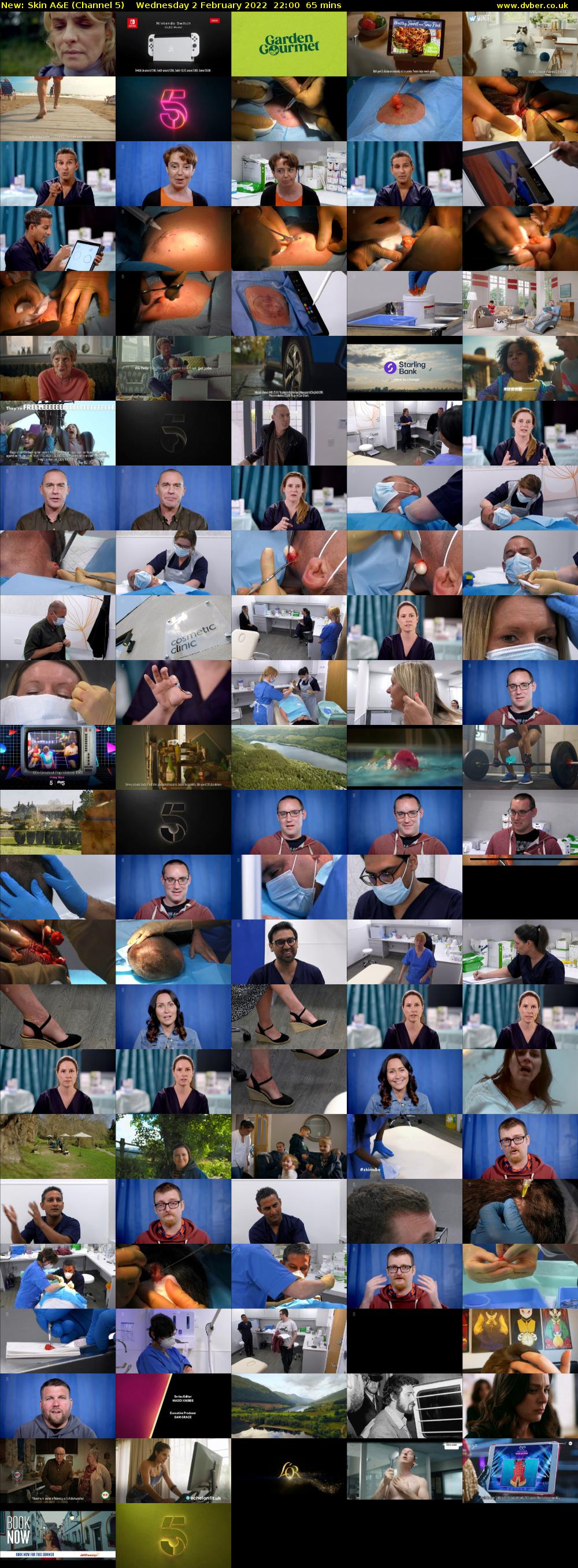 Skin A&E (Channel 5) Wednesday 2 February 2022 22:00 - 23:05