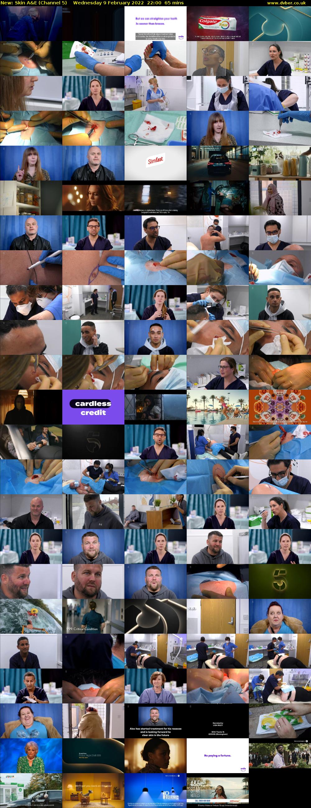 Skin A&E (Channel 5) Wednesday 9 February 2022 22:00 - 23:05