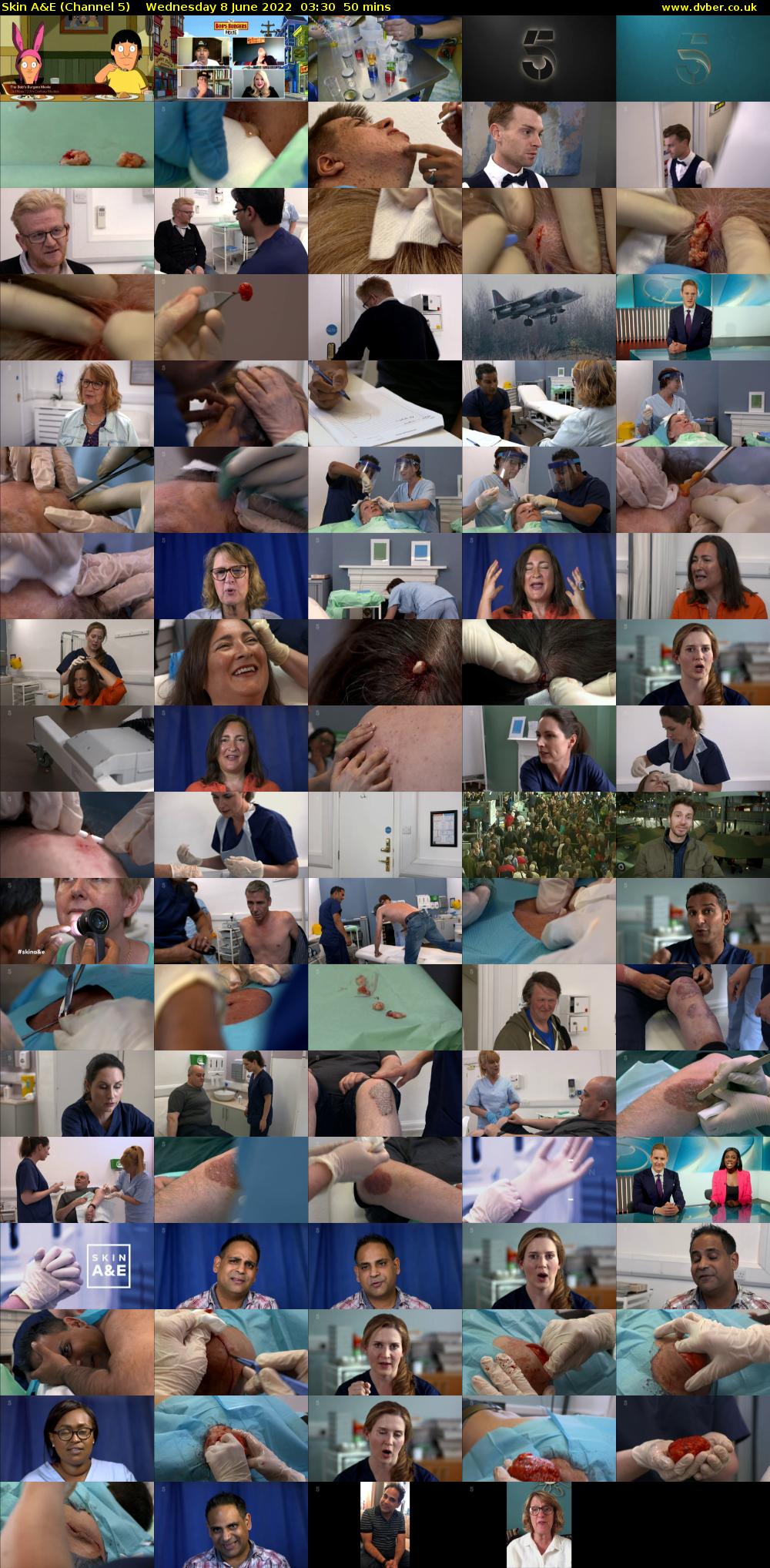 Skin A&E (Channel 5) Wednesday 8 June 2022 03:30 - 04:20