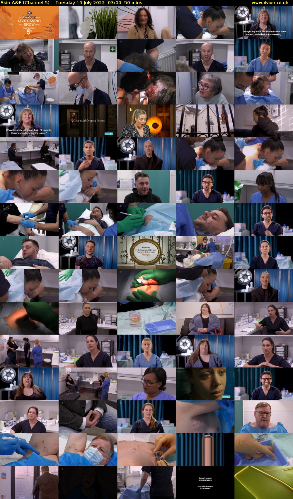Skin A&E (Channel 5) Tuesday 19 July 2022 03:00 - 03:50