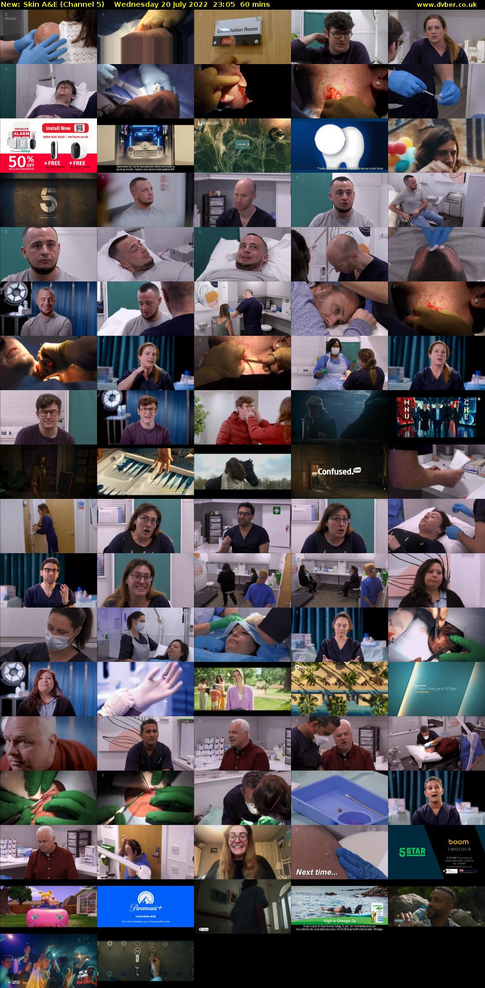 Skin A&E (Channel 5) Wednesday 20 July 2022 23:05 - 00:05