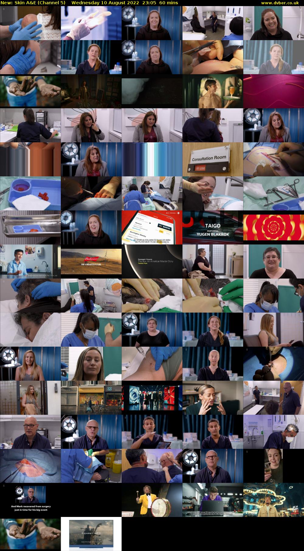 Skin A&E (Channel 5) Wednesday 10 August 2022 23:05 - 00:05