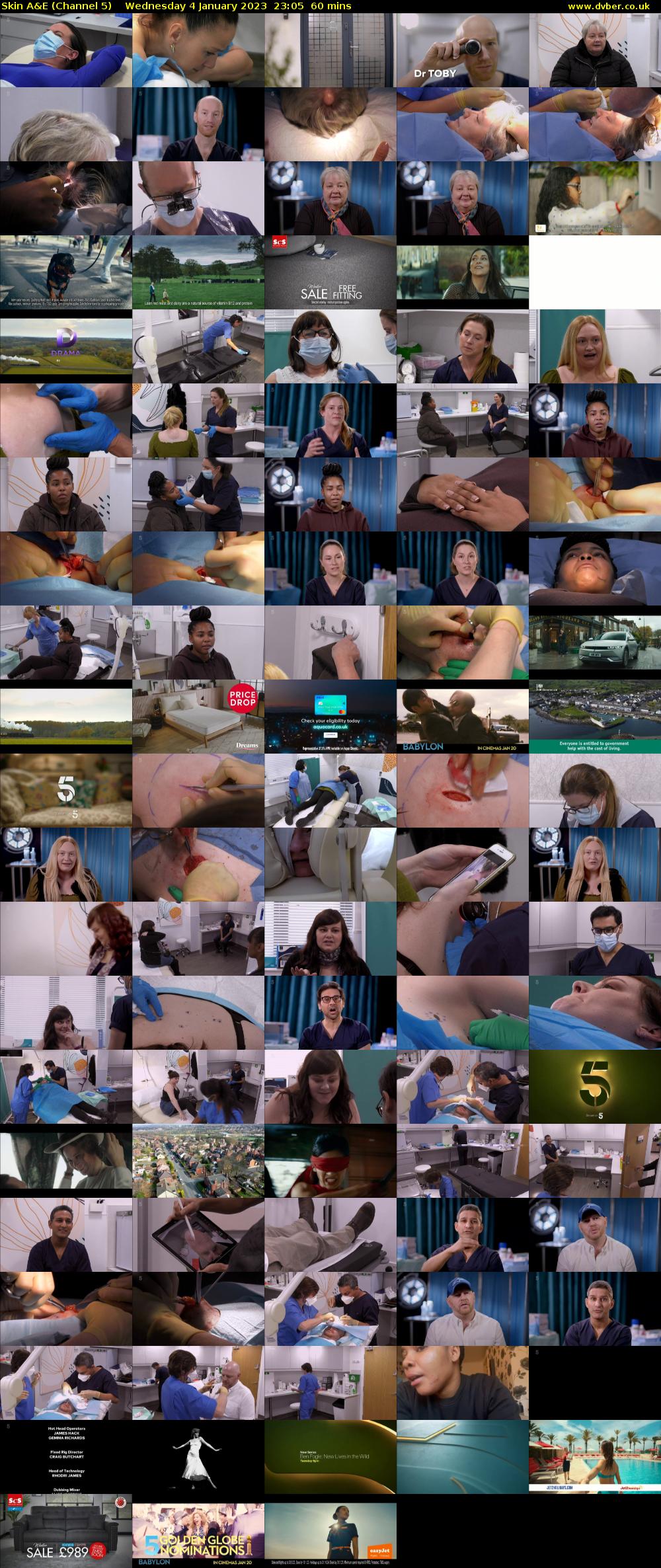 Skin A&E (Channel 5) Wednesday 4 January 2023 23:05 - 00:05