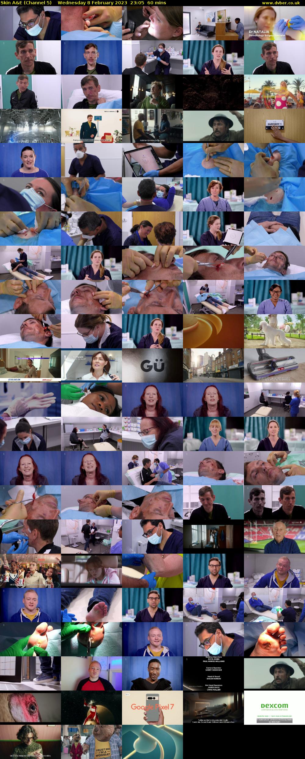 Skin A&E (Channel 5) Wednesday 8 February 2023 23:05 - 00:05