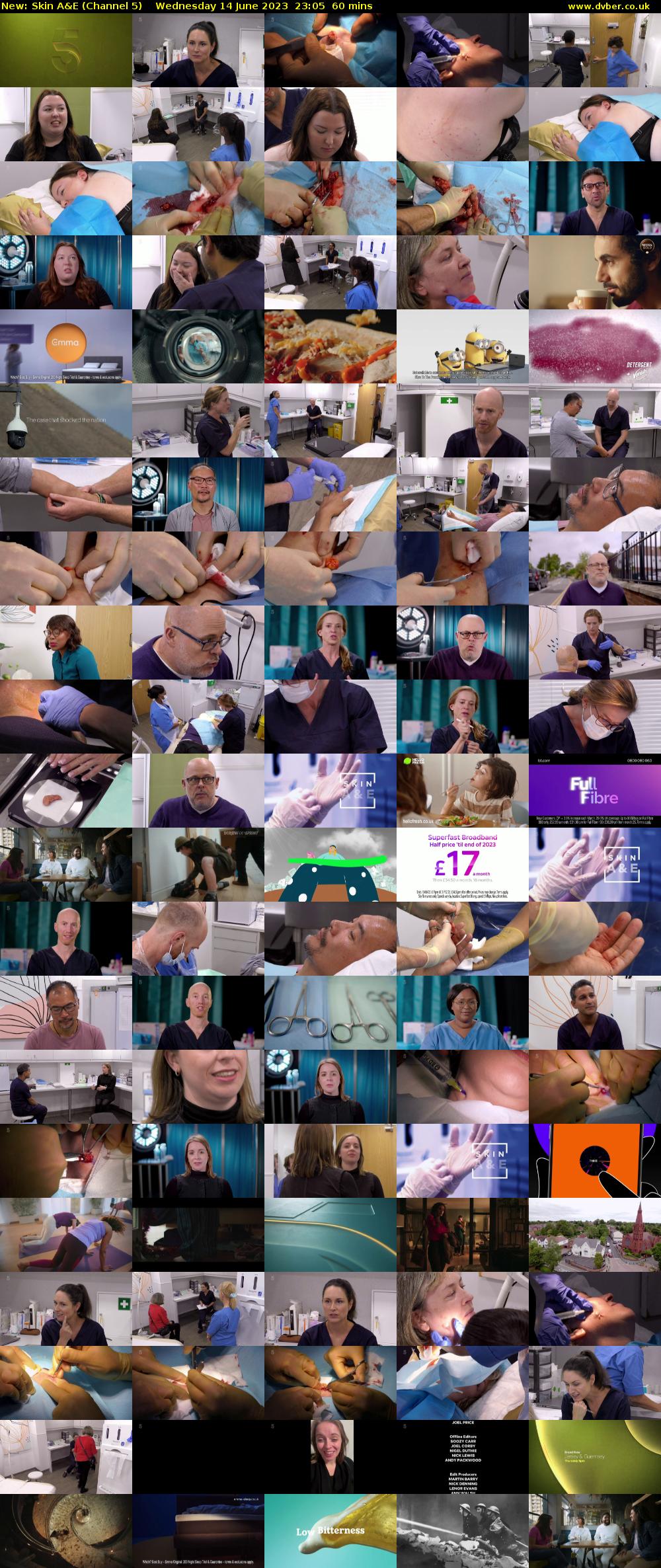 Skin A&E (Channel 5) Wednesday 14 June 2023 23:05 - 00:05