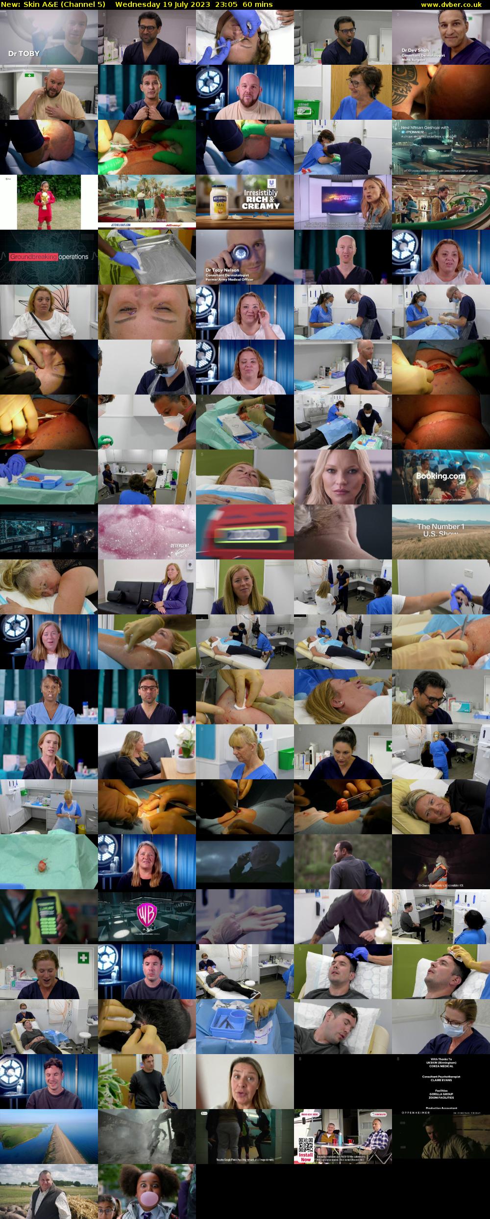 Skin A&E (Channel 5) Wednesday 19 July 2023 23:05 - 00:05