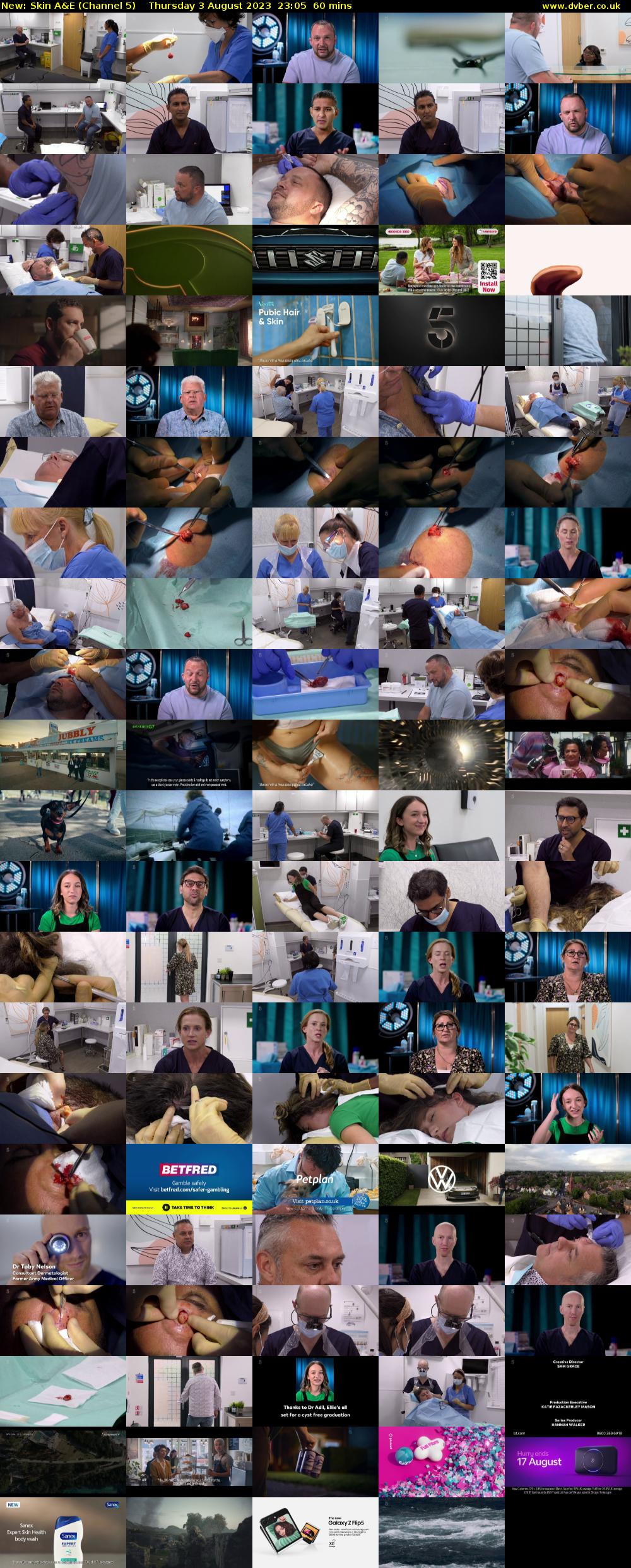 Skin A&E (Channel 5) Thursday 3 August 2023 23:05 - 00:05