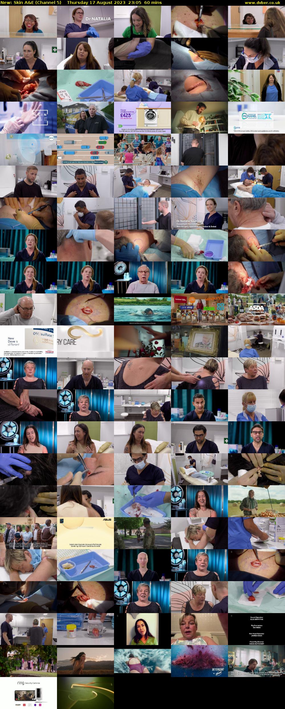 Skin A&E (Channel 5) Thursday 17 August 2023 23:05 - 00:05