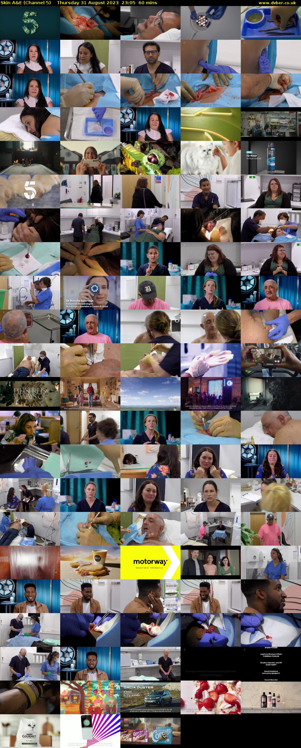 Skin A&E (Channel 5) Thursday 31 August 2023 23:05 - 00:05