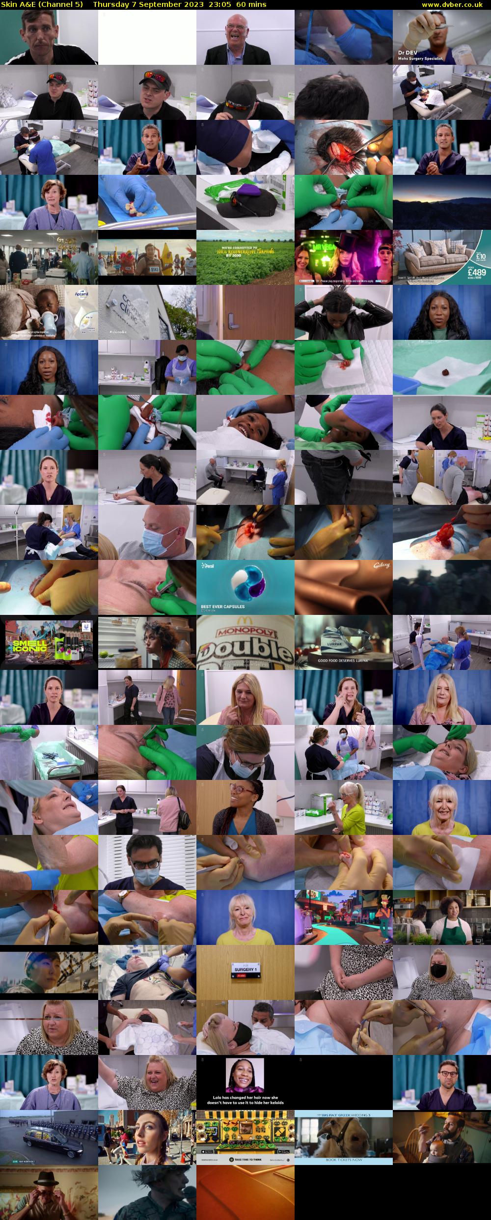 Skin A&E (Channel 5) Thursday 7 September 2023 23:05 - 00:05