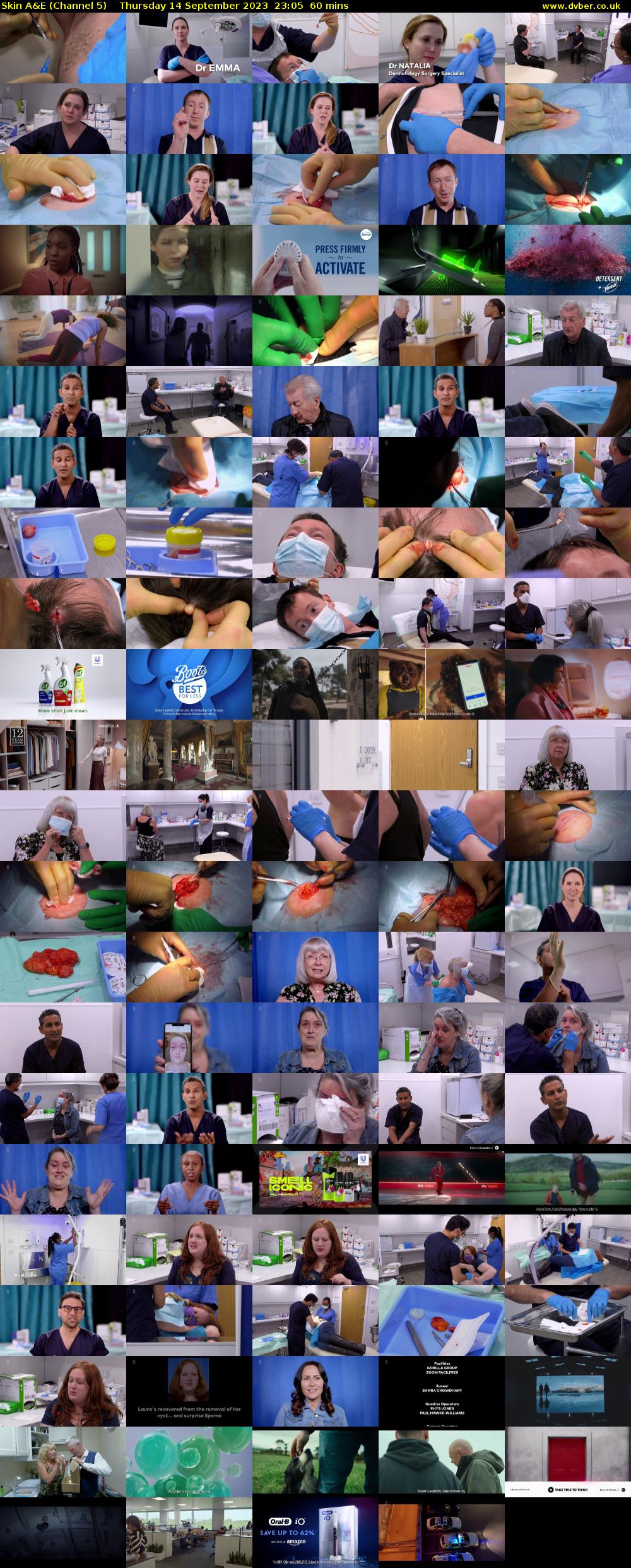 Skin A&E (Channel 5) Thursday 14 September 2023 23:05 - 00:05