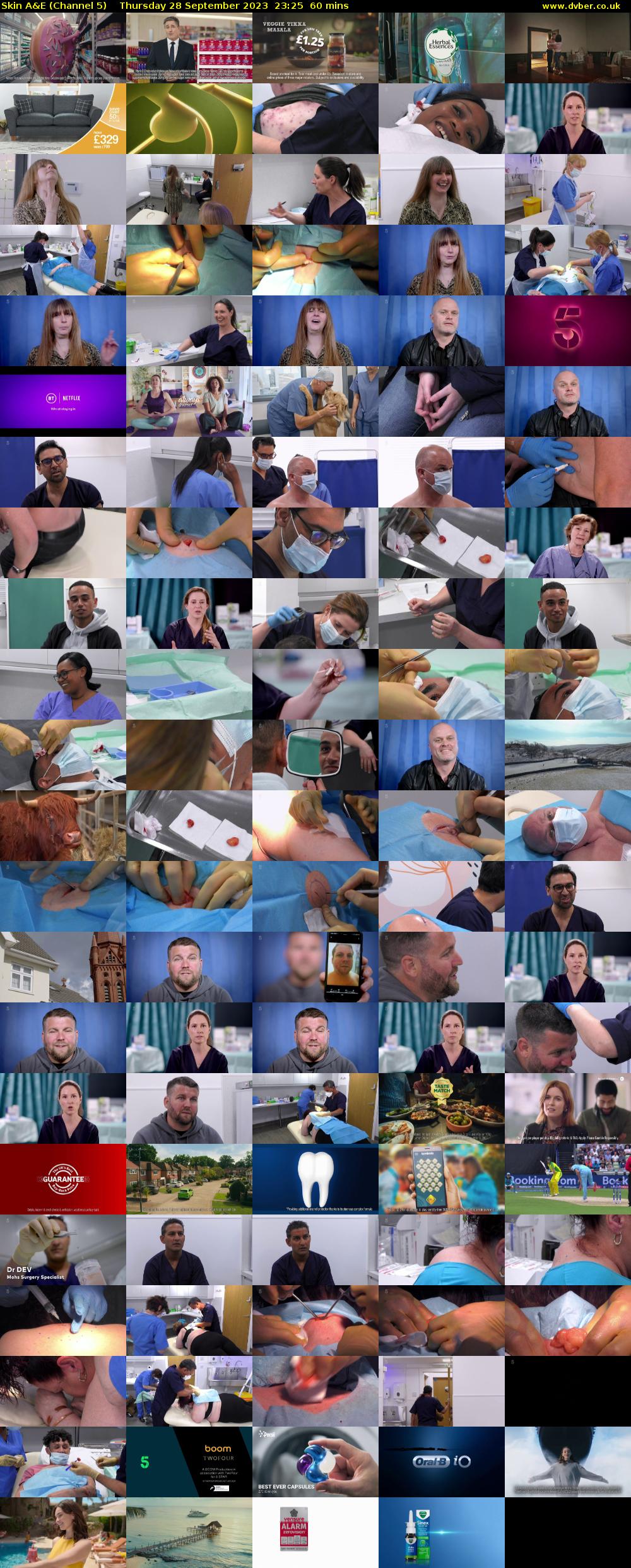 Skin A&E (Channel 5) Thursday 28 September 2023 23:25 - 00:25