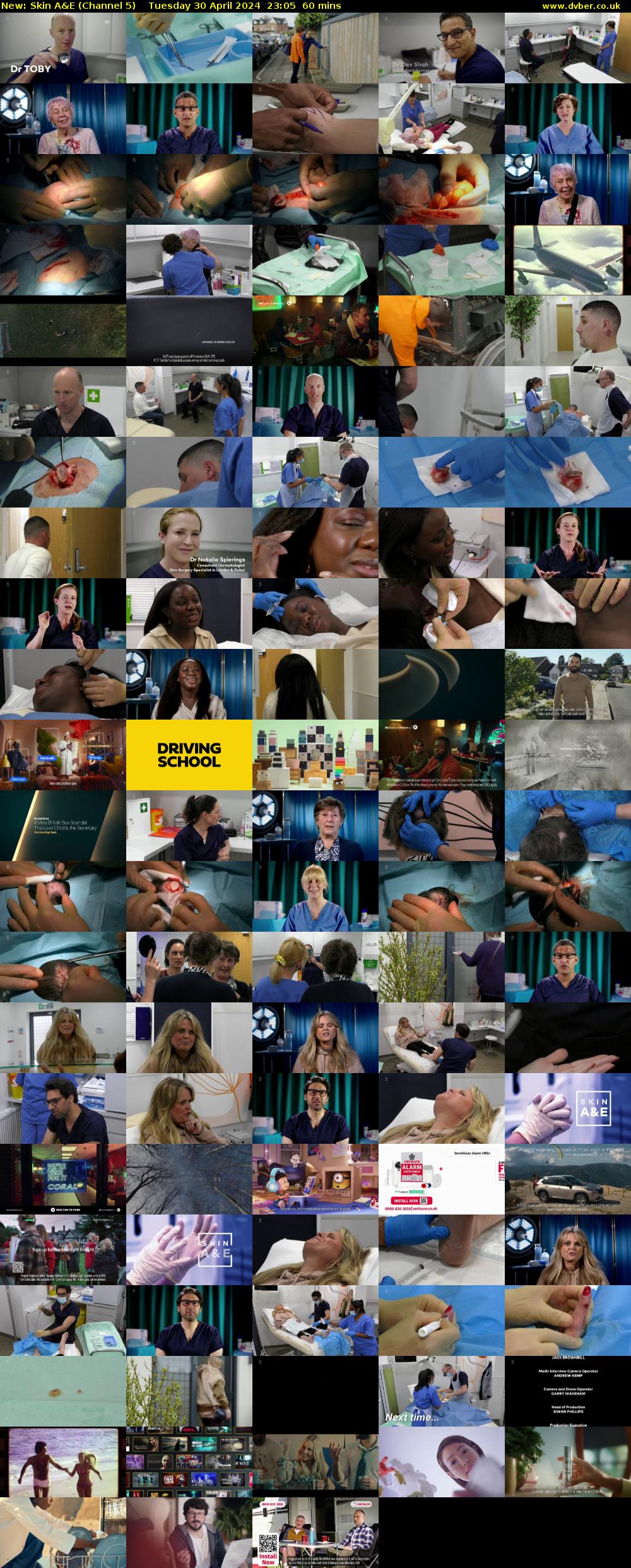 Skin A&E (Channel 5) Tuesday 30 April 2024 23:05 - 00:05