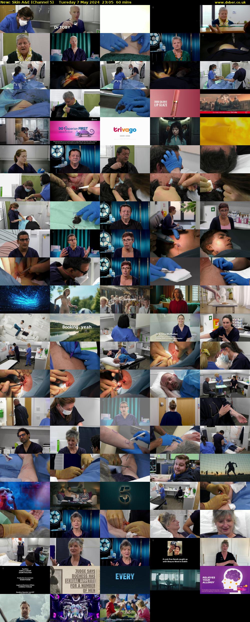 Skin A&E (Channel 5) Tuesday 7 May 2024 23:05 - 00:05