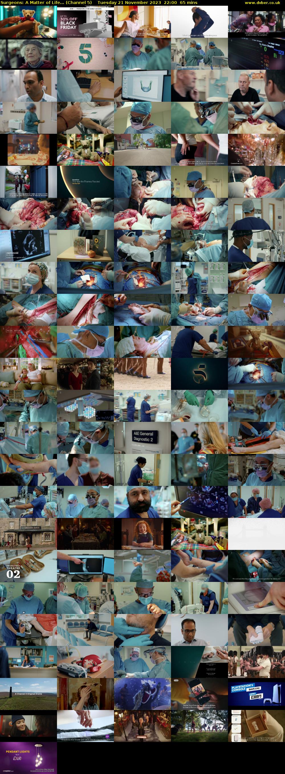 Surgeons: A Matter of Life... (Channel 5) Tuesday 21 November 2023 22:00 - 23:05