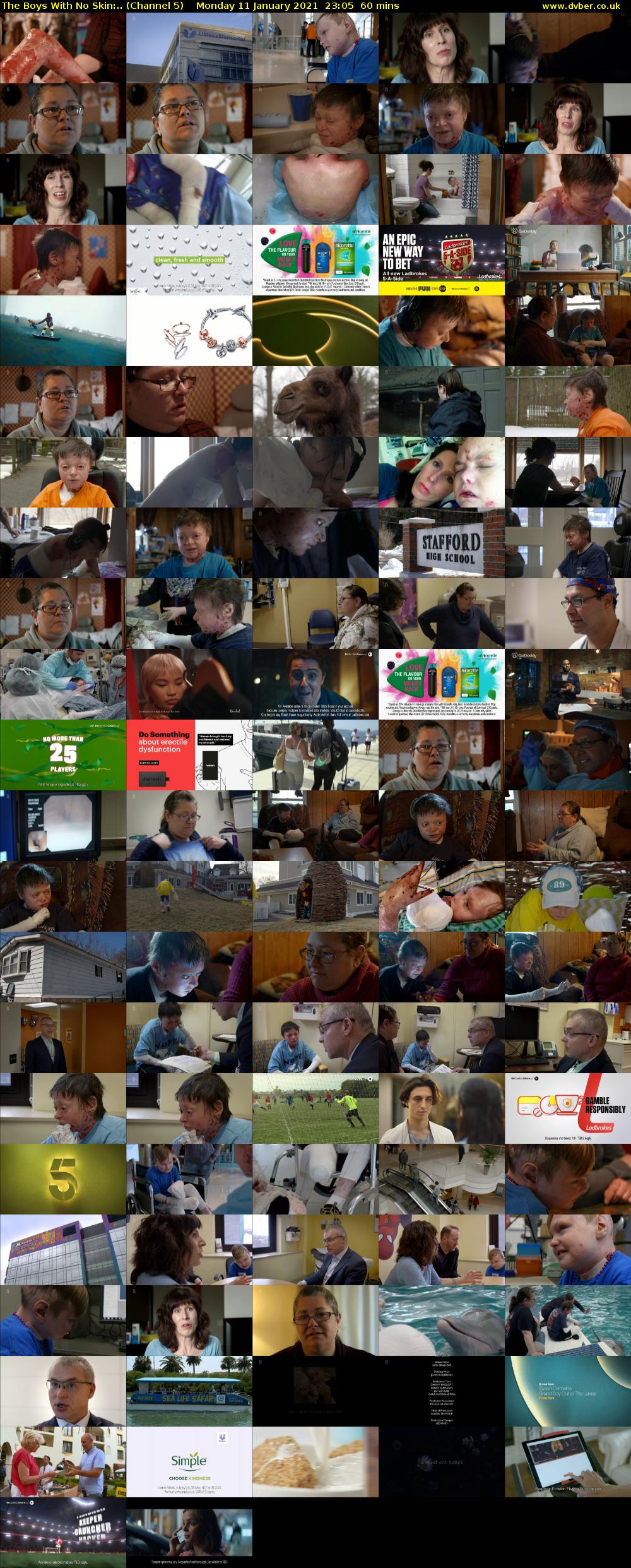 The Boys With No Skin:.. (Channel 5) Monday 11 January 2021 23:05 - 00:05