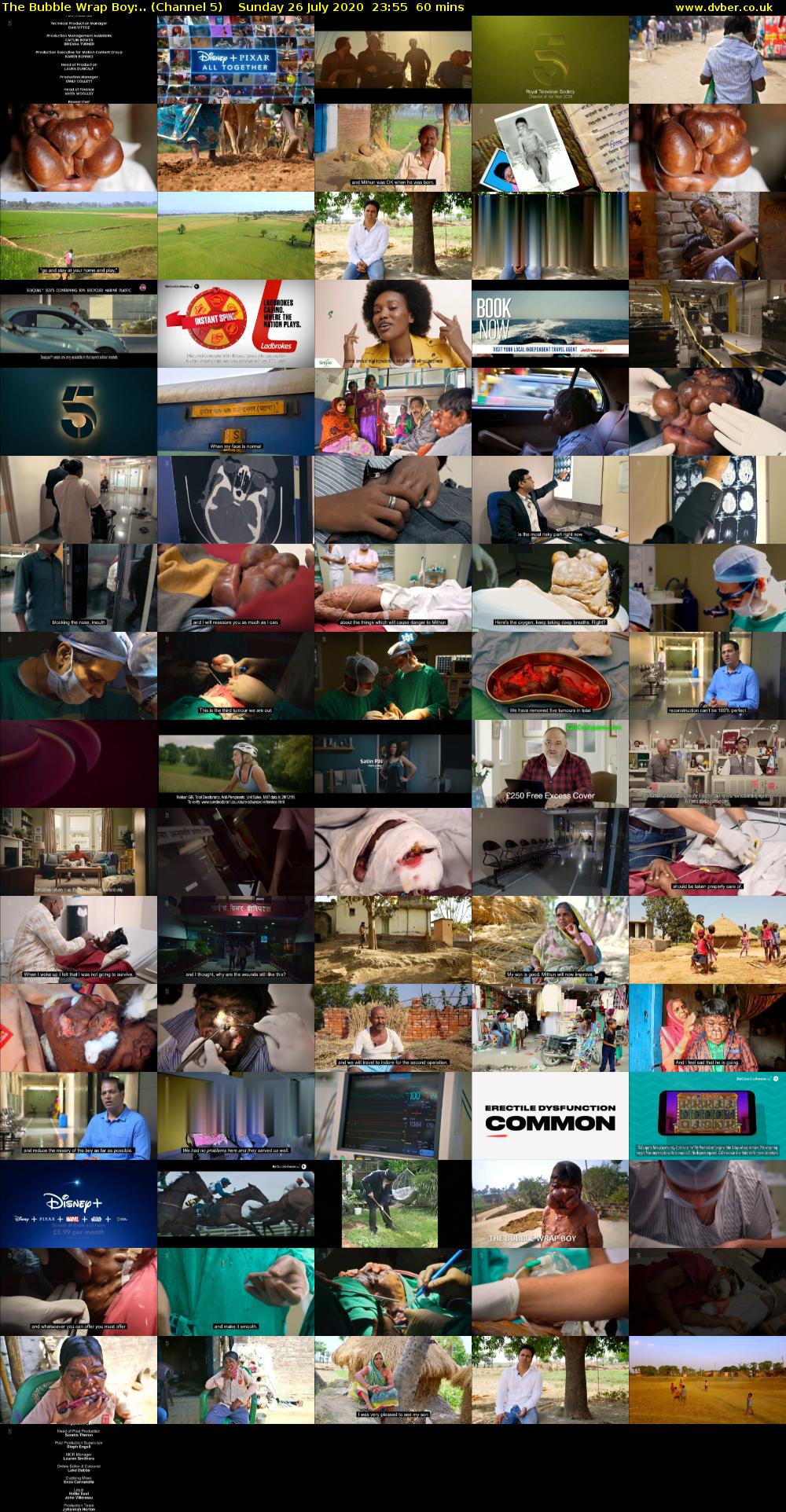 The Bubble Wrap Boy:.. (Channel 5) Sunday 26 July 2020 23:55 - 00:55