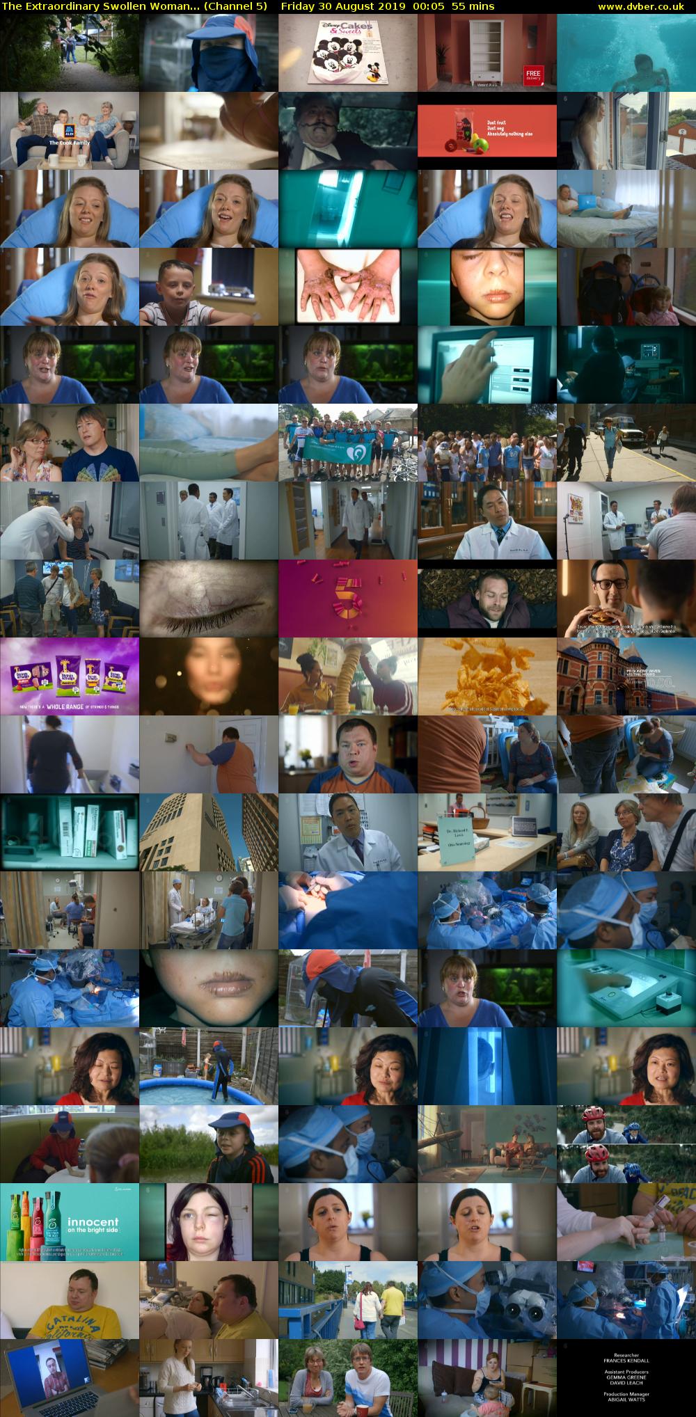 The Extraordinary Swollen Woman... (Channel 5) Friday 30 August 2019 00:05 - 01:00