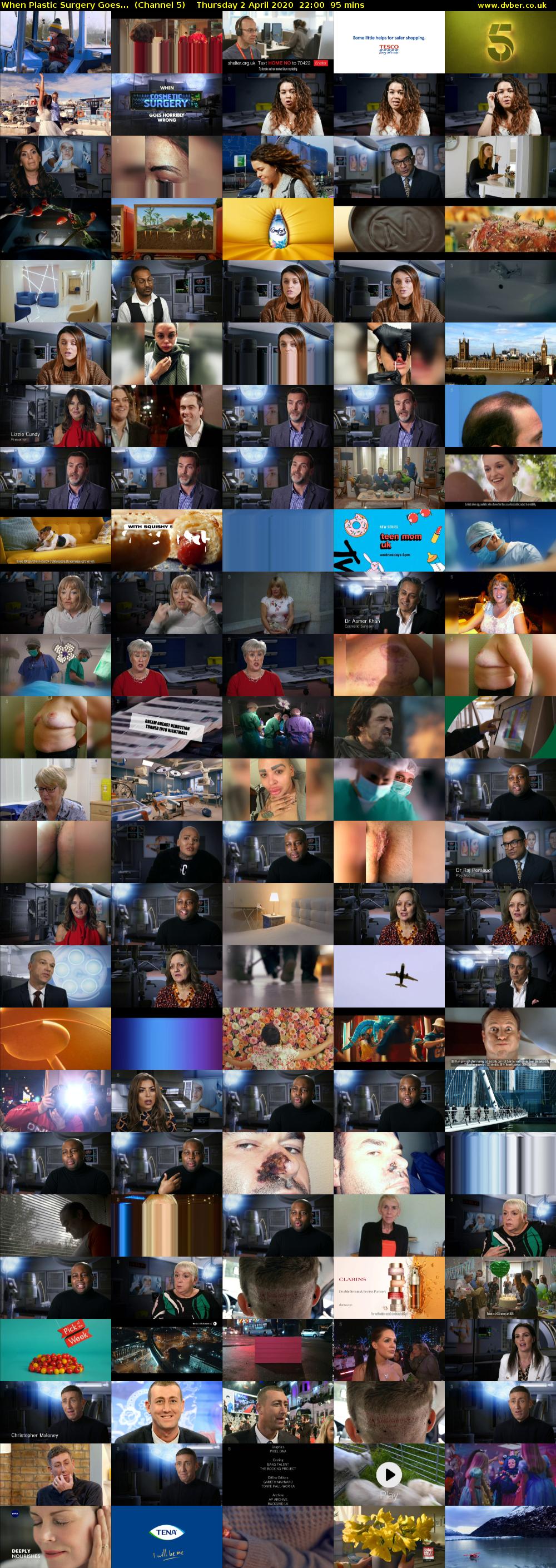 When Plastic Surgery Goes...  (Channel 5) Thursday 2 April 2020 22:00 - 23:35