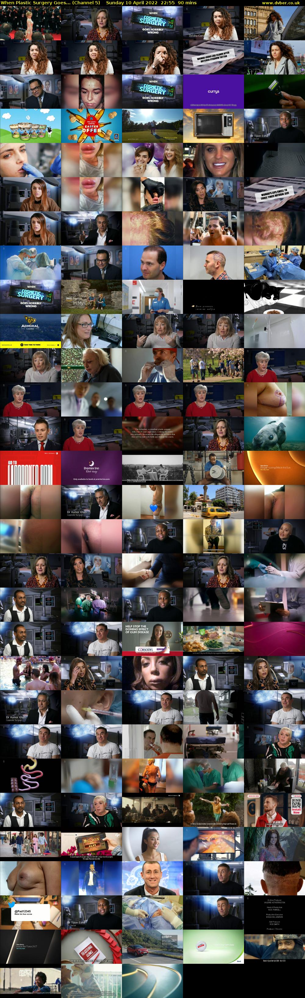 When Plastic Surgery Goes... (Channel 5) Sunday 10 April 2022 22:55 - 00:25