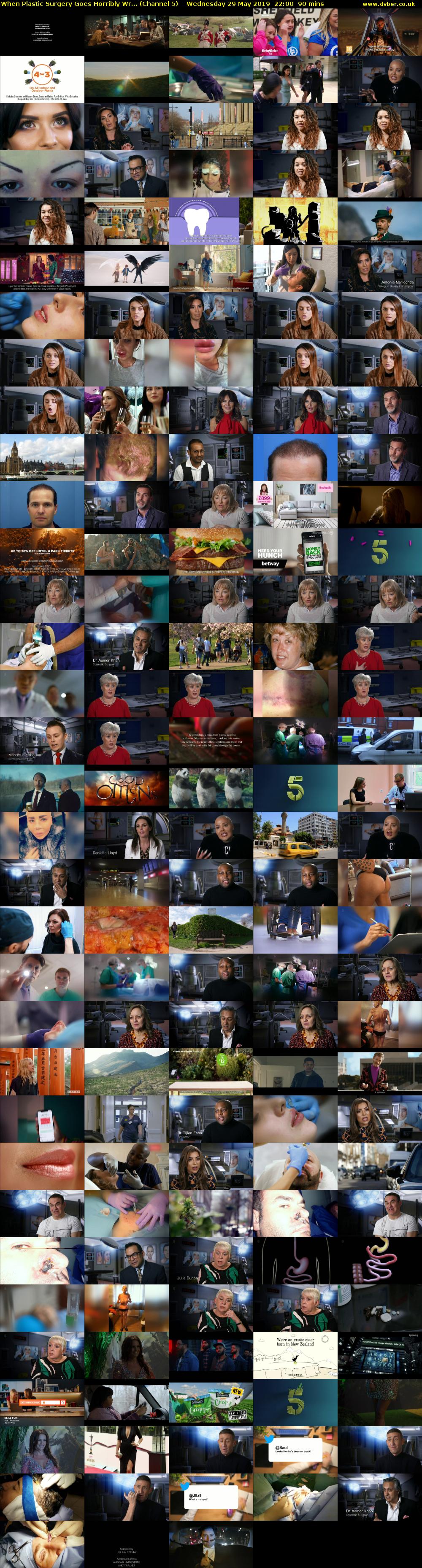When Plastic Surgery Goes Horribly Wr... (Channel 5) Wednesday 29 May 2019 22:00 - 23:30