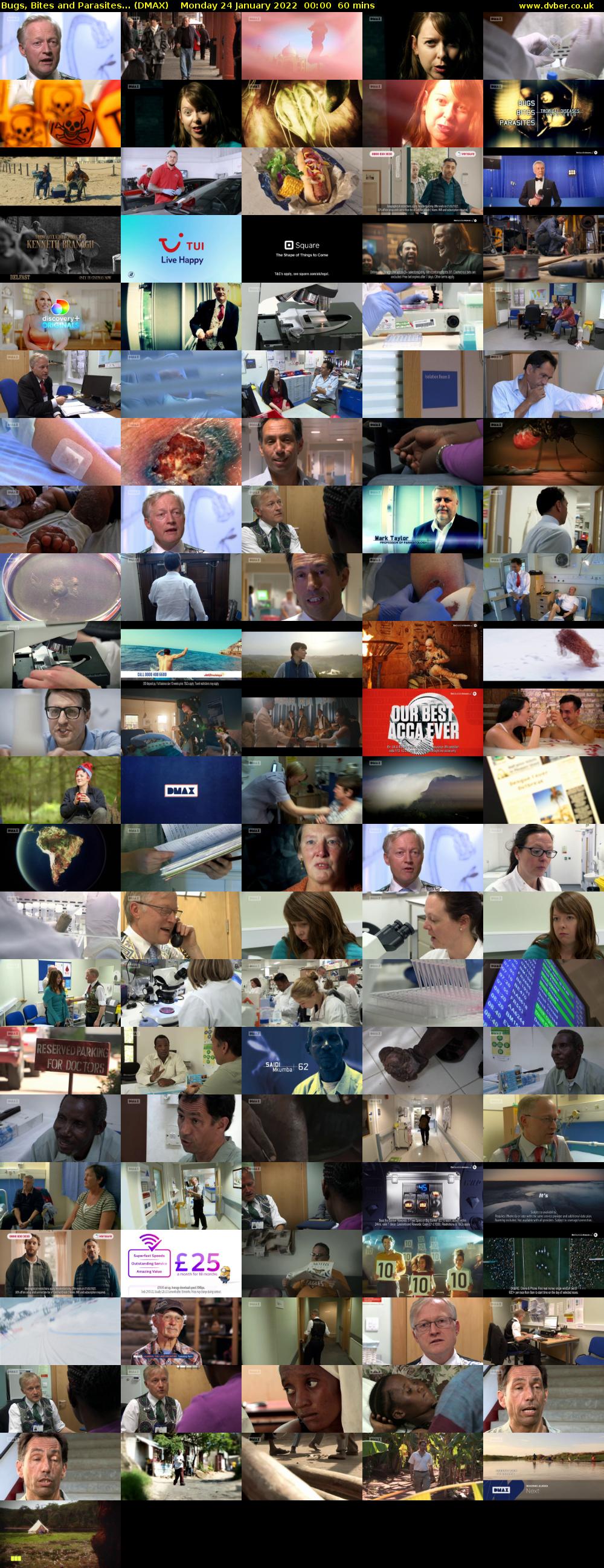 Bugs, Bites and Parasites... (DMAX) Monday 24 January 2022 00:00 - 01:00