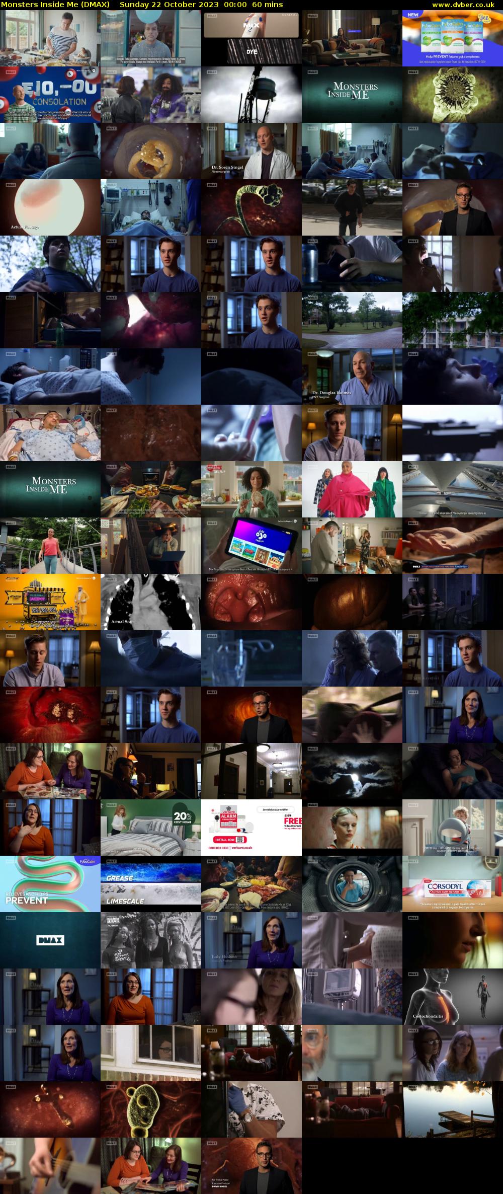Monsters Inside Me (DMAX) Sunday 22 October 2023 00:00 - 01:00