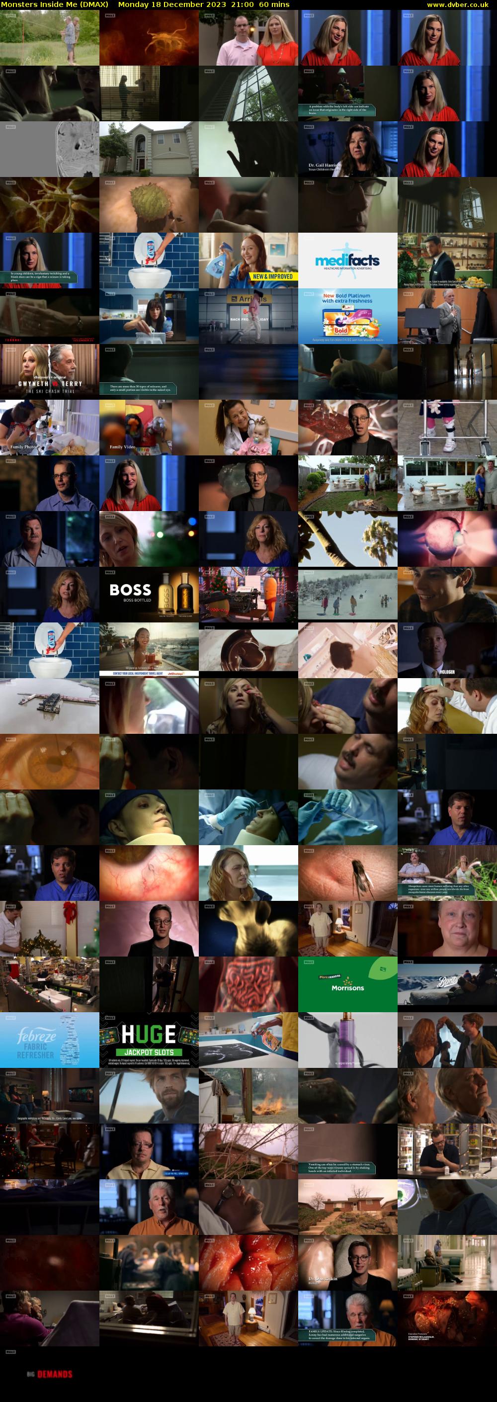 Monsters Inside Me (DMAX) Monday 18 December 2023 21:00 - 22:00