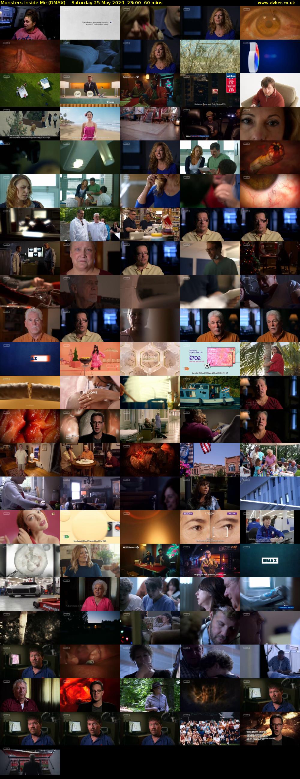Monsters Inside Me (DMAX) Saturday 25 May 2024 23:00 - 00:00
