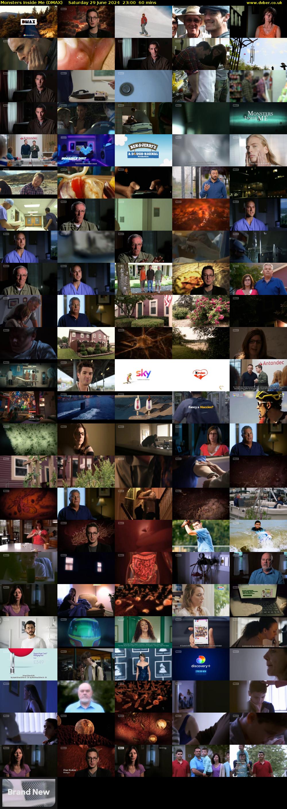 Monsters Inside Me (DMAX) Saturday 29 June 2024 23:00 - 00:00