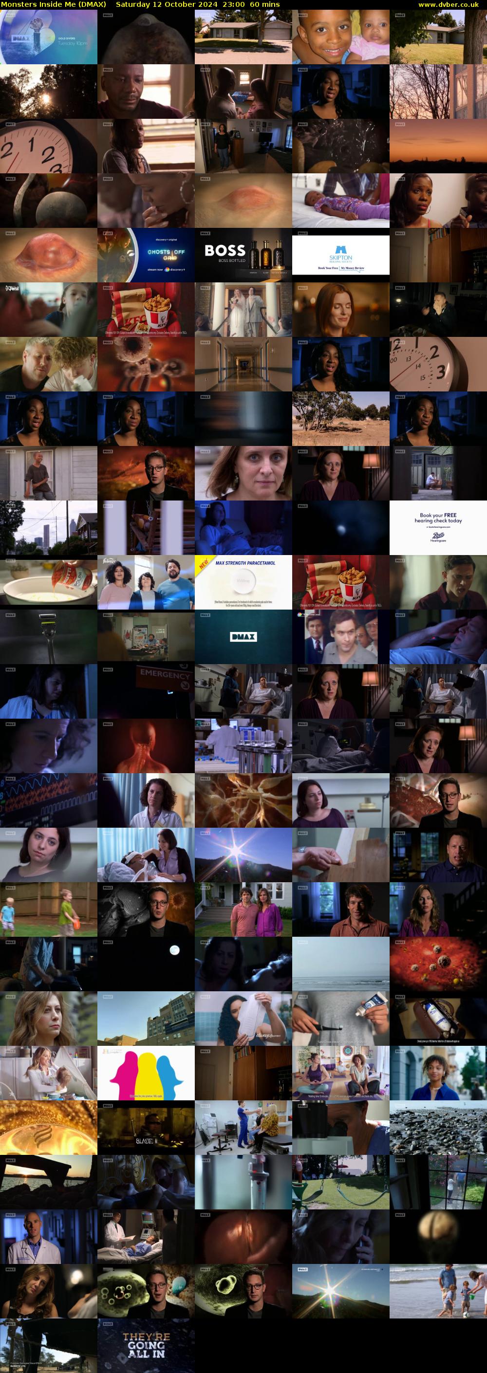 Monsters Inside Me (DMAX) Saturday 12 October 2024 23:00 - 00:00