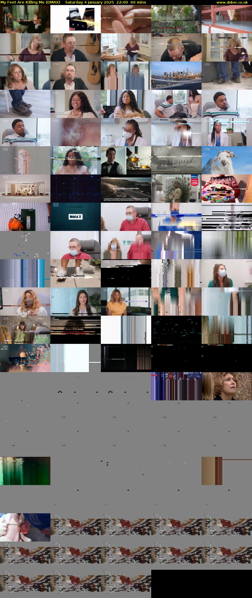 My Feet Are Killing Me (DMAX) Saturday 4 January 2025 22:00 - 23:00