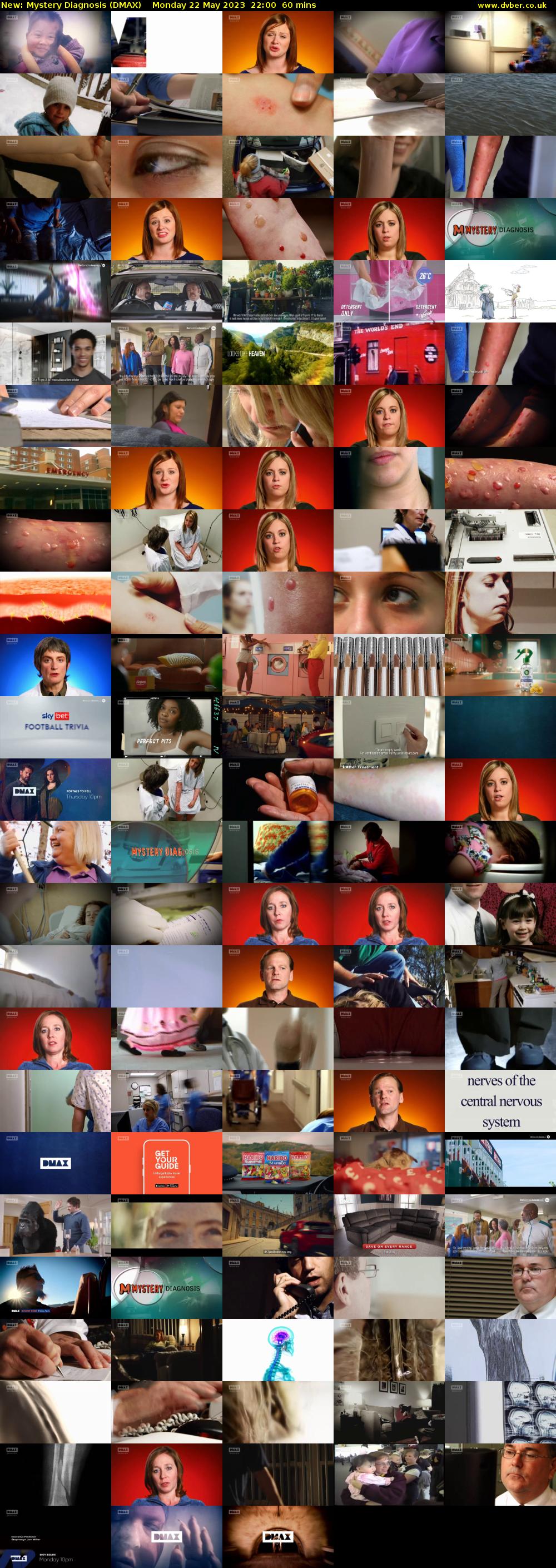 Mystery Diagnosis (DMAX) Monday 22 May 2023 22:00 - 23:00