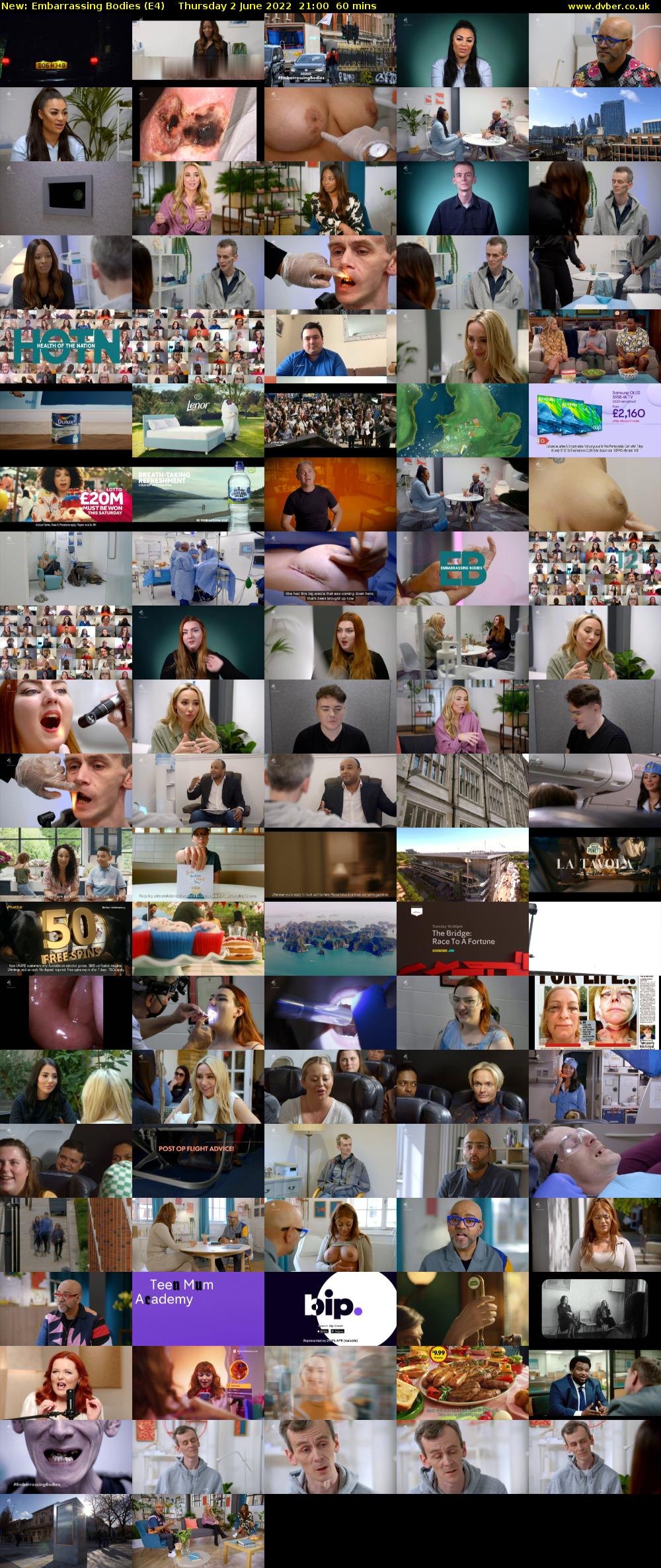 Embarrassing Bodies (E4) Thursday 2 June 2022 21:00 - 22:00