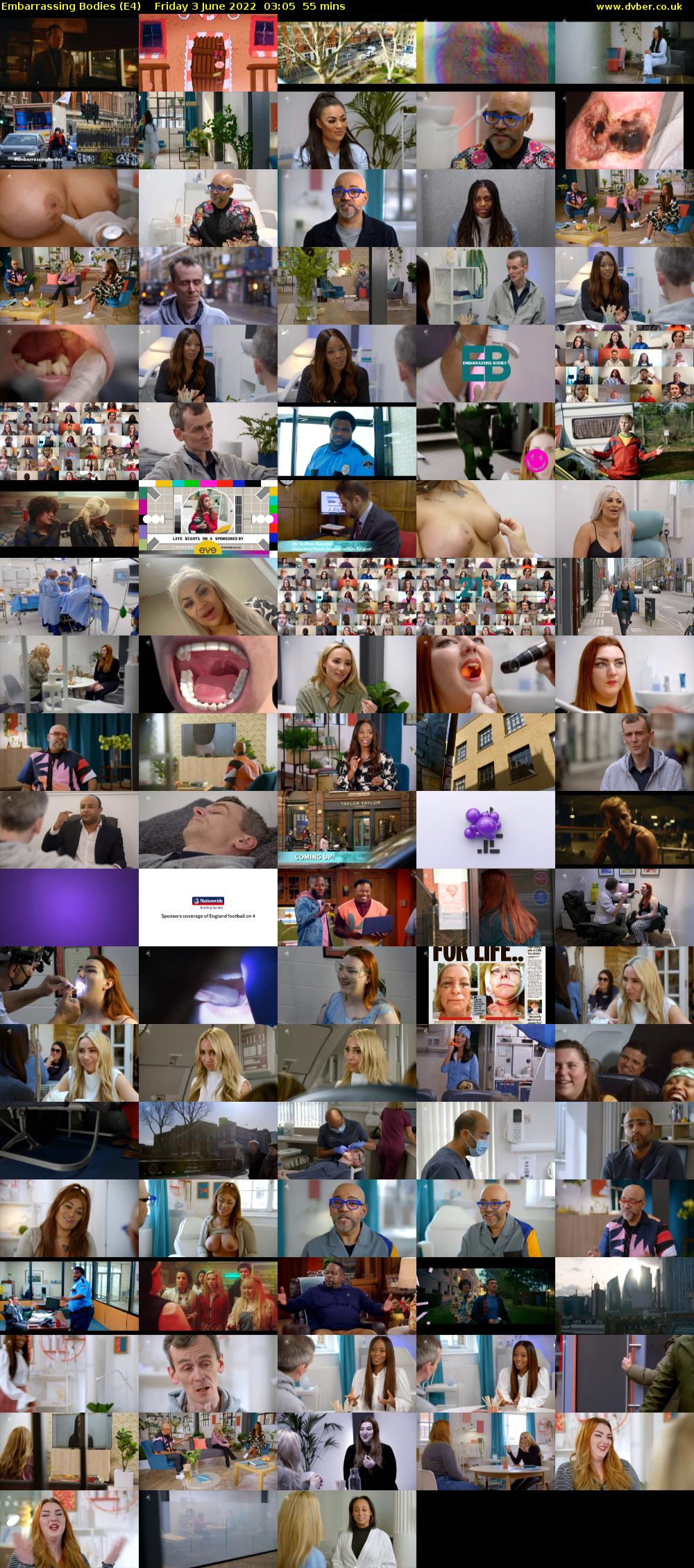 Embarrassing Bodies (E4) Friday 3 June 2022 03:05 - 04:00