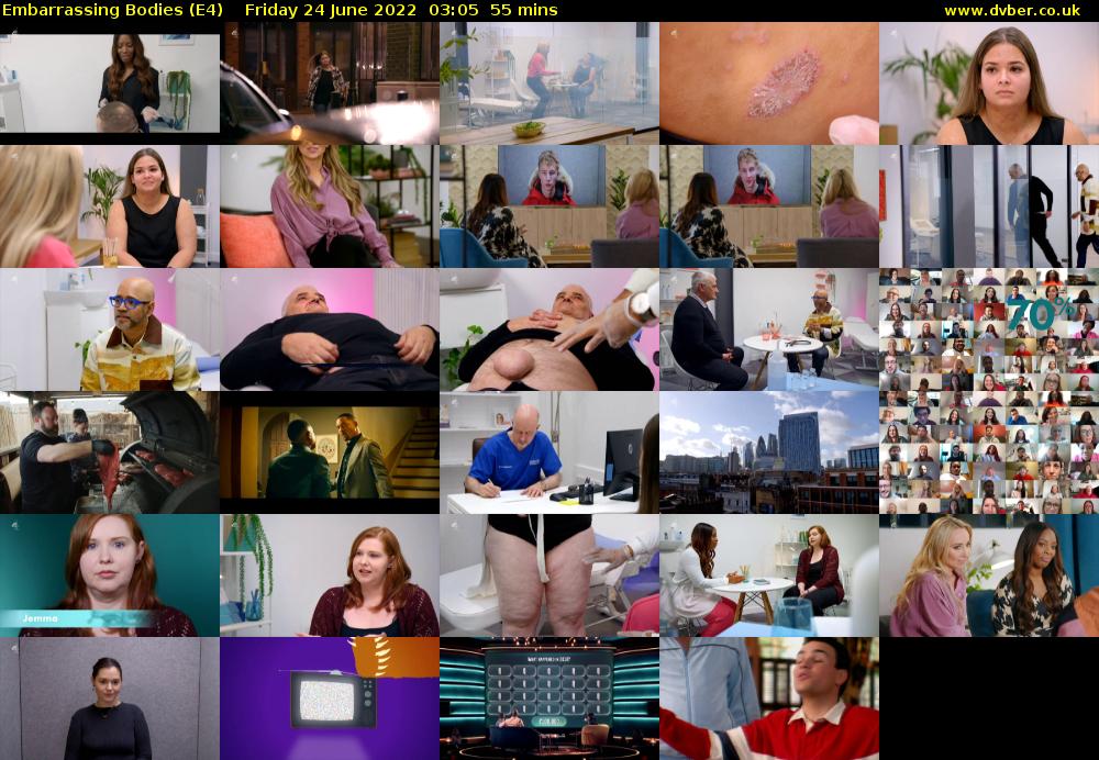 Embarrassing Bodies (E4) Friday 24 June 2022 03:05 - 04:00