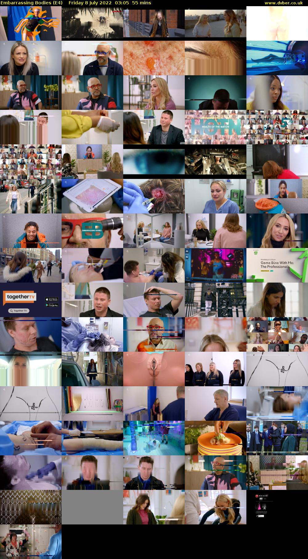 Embarrassing Bodies (E4) Friday 8 July 2022 03:05 - 04:00