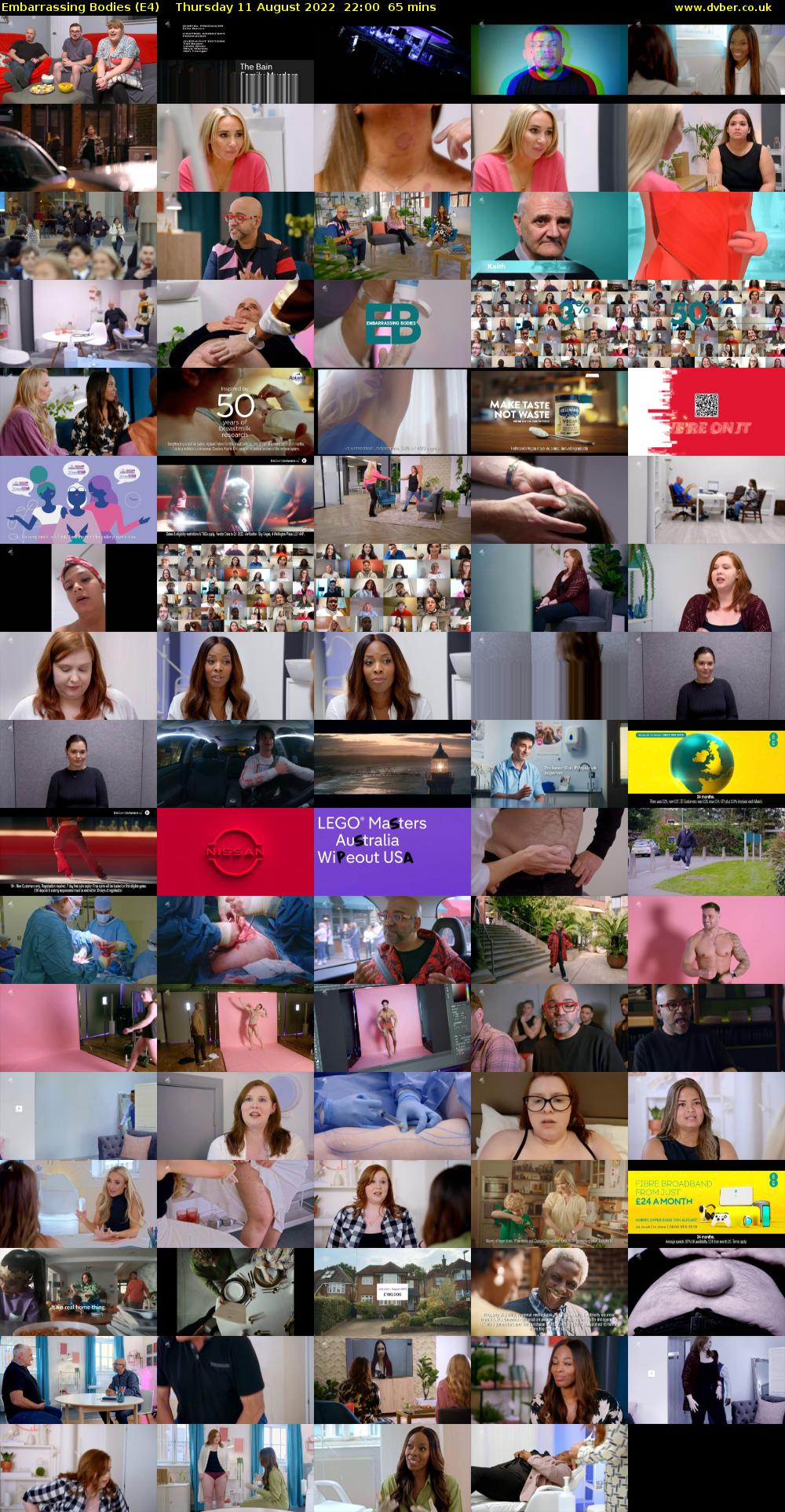 Embarrassing Bodies (E4) Thursday 11 August 2022 22:00 - 23:05