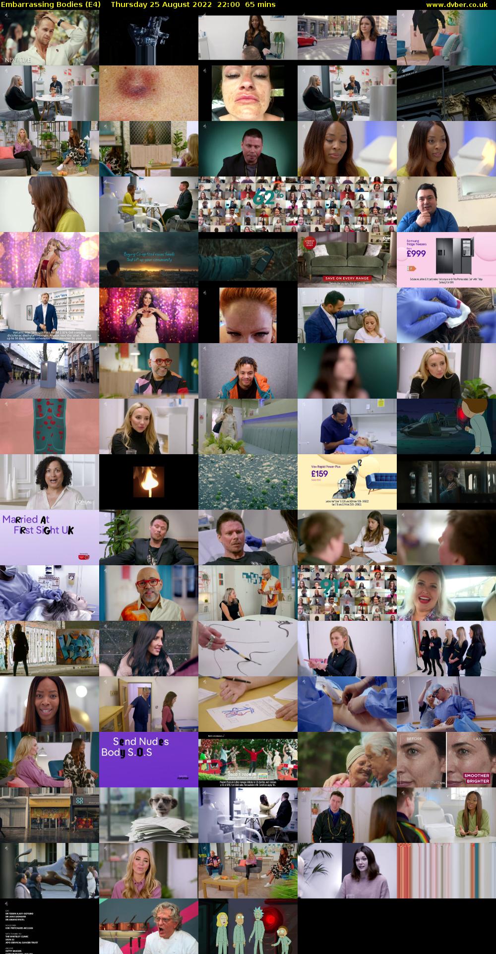 Embarrassing Bodies (E4) Thursday 25 August 2022 22:00 - 23:05