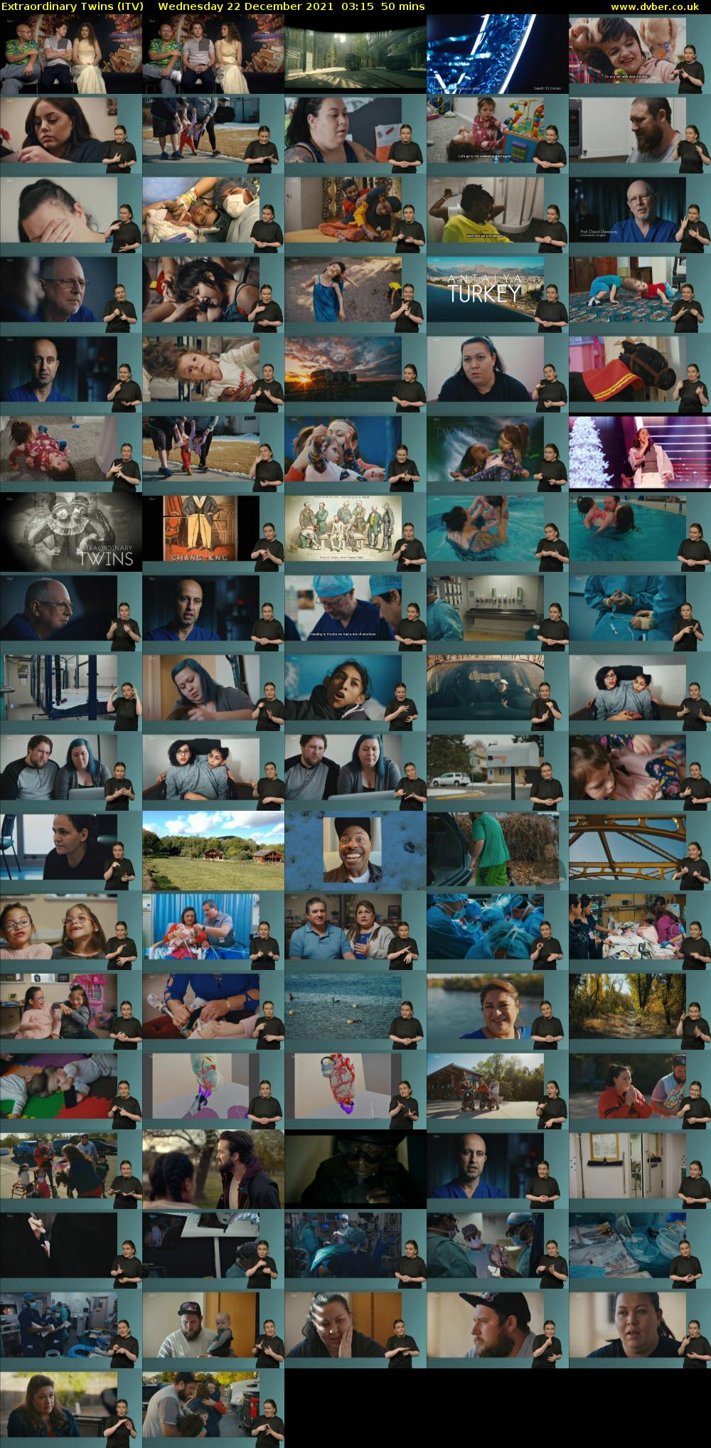 Extraordinary Twins (ITV) Wednesday 22 December 2021 03:15 - 04:05