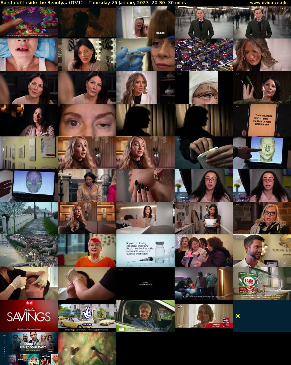 Botched? Inside the Beauty... (ITV1) Thursday 26 January 2023 20:30 - 21:00