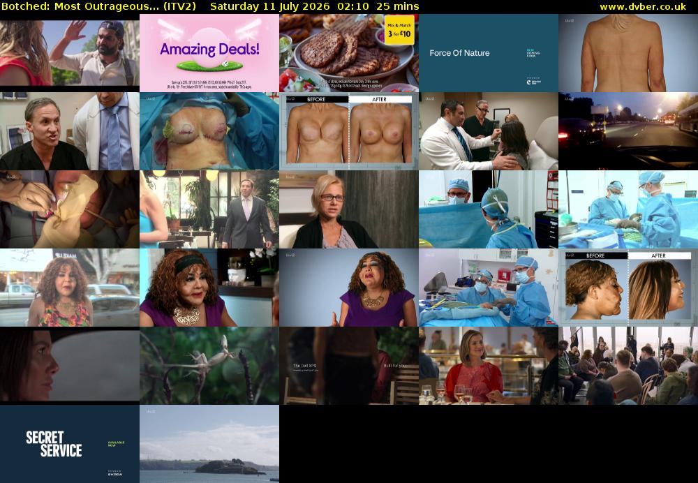 Botched: Most Outrageous... (ITV2) Saturday 11 July 2026 02:10 - 02:35
